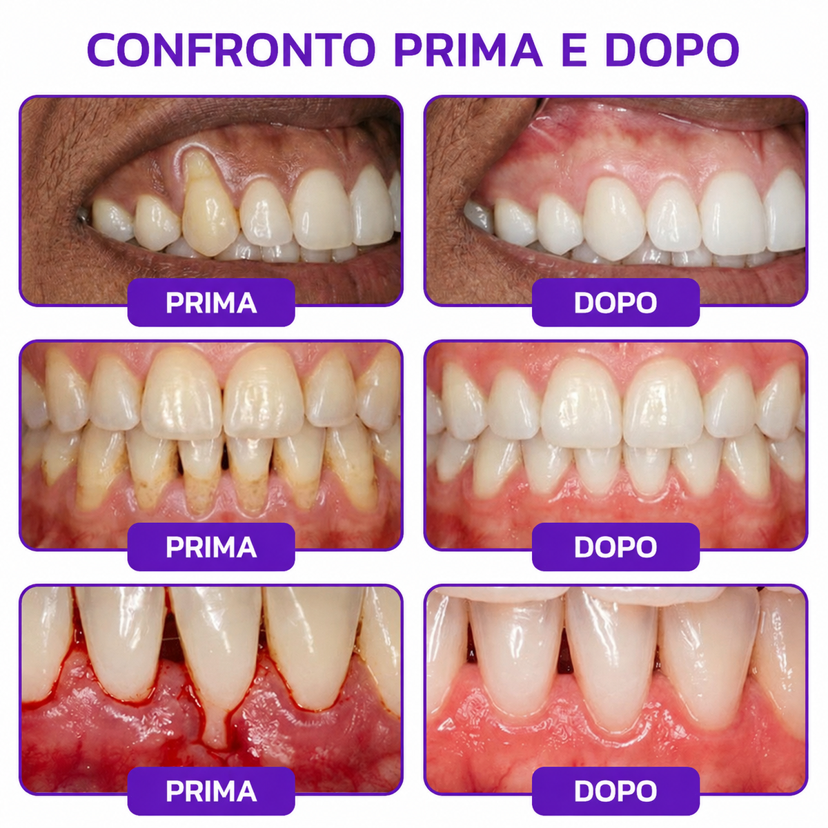 Rolimey® VioCore » Dentifricio al veleno d’api per gengivite e parodontite