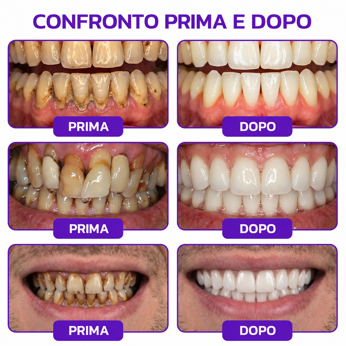 Rolimey® VioCore » Dentifricio al veleno d’api per gengivite e parodontite
