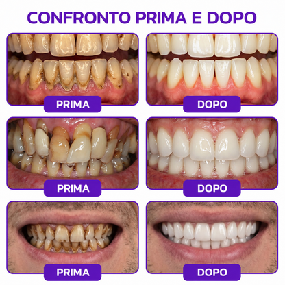 Rolimey® VioCore » Dentifricio al veleno d’api per gengivite e parodontite